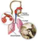 asthma-natural-treatment.jpg