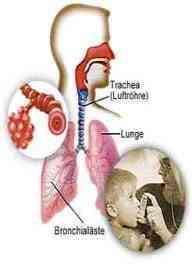 Lung disease affects children and elderly people the most.  Asthma, allergies, bronchitis, and sinusitis are just some of the more common respiratory diseases cause by air pollution