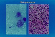 Histoplasma capsulatum yeast cells.