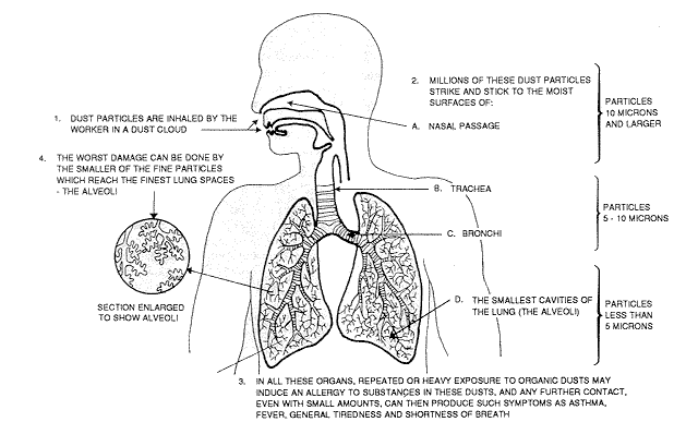 Here is the what happens when dust is inhaled into your lungs