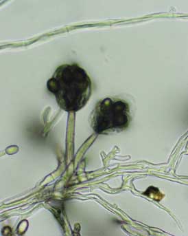 Mold hyphae.