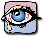 Watery eyes or burning eyes is a very common Allergy Symptom.