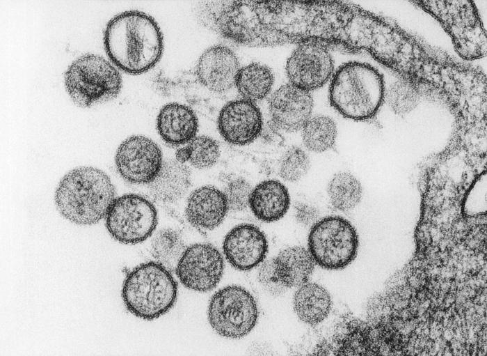 Image of Hanta Virus
