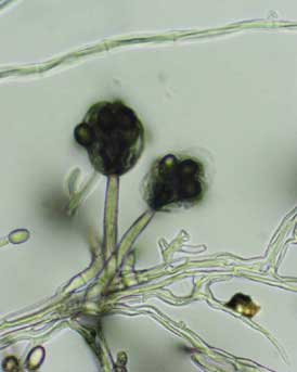 Mold hyphae.